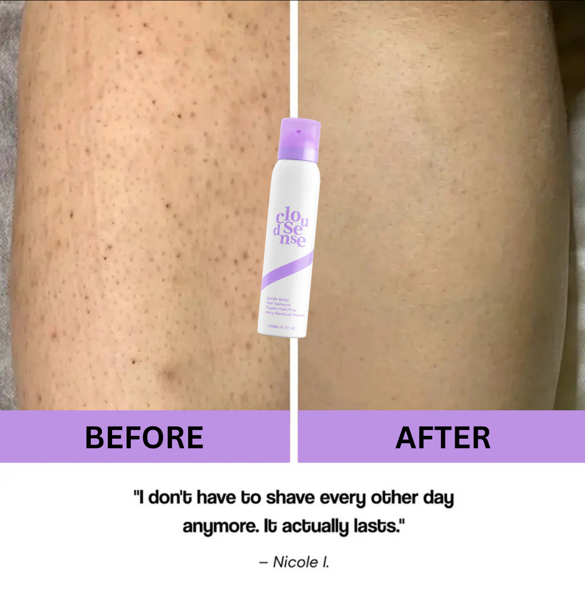Pro Bikini Pain Free Hair Removal For Sensitive Skin-Ultra Smooth Skin in Minutes